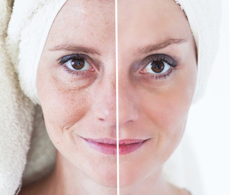 pterostilbene for anti aging